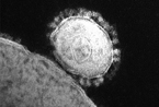 国际组织为新型病毒征名