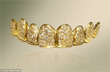 迪拜牙医黄金钻石打造假牙