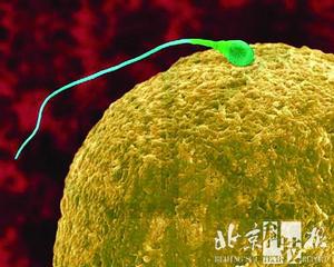 用亡夫冷冻精子受孕合不合理 (2)