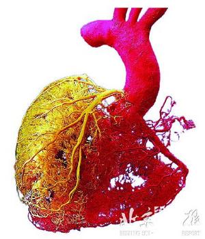 心脏10个惊人事实 性高潮减少冠心病