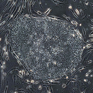 人体表皮制造类胚胎干细胞取得成功