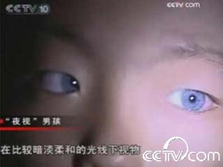 广西 猫眼 <em>男孩</em>瞳孔呈<em>蓝色</em>+具神奇夜视能力--科