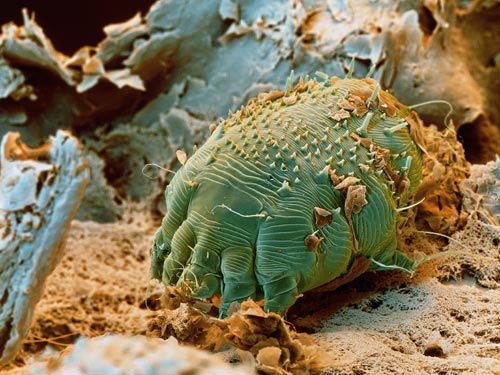 人体十大寄生虫:弓形虫会侵袭中枢神经系统